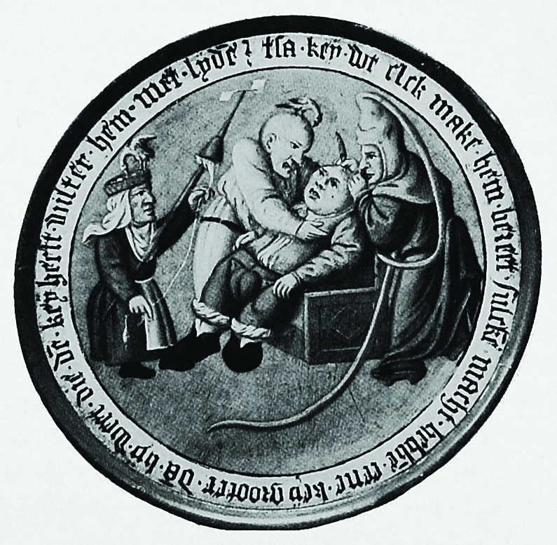 The Stone Operation