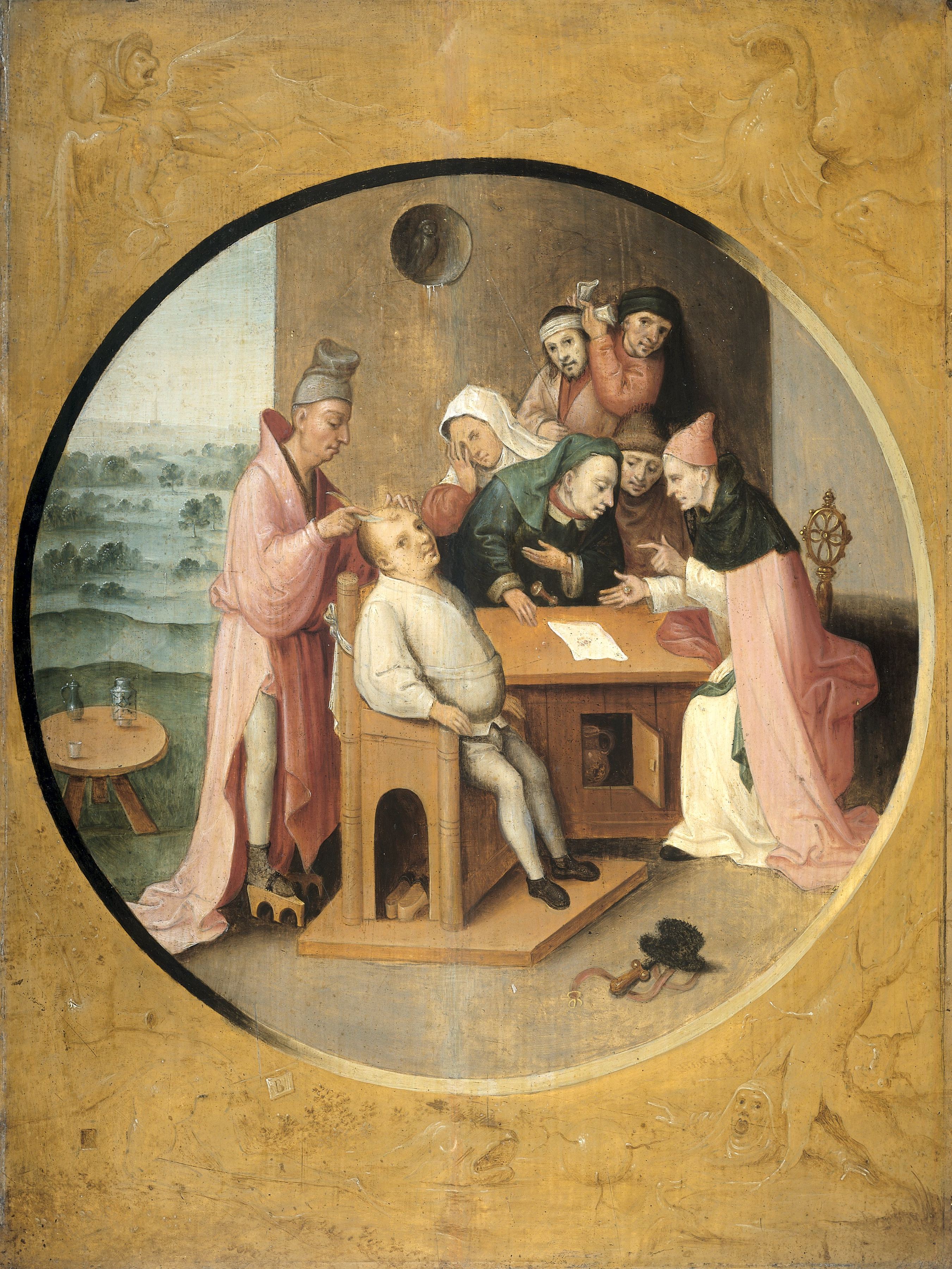 The Extraction of the Stone of Folly