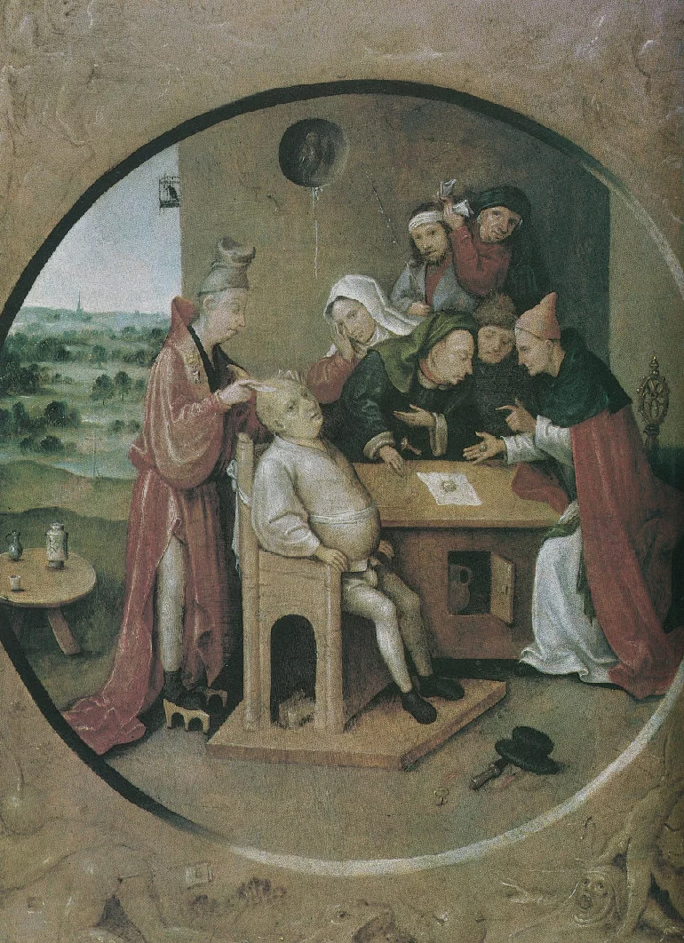 The Extraction of the Stone of Folly