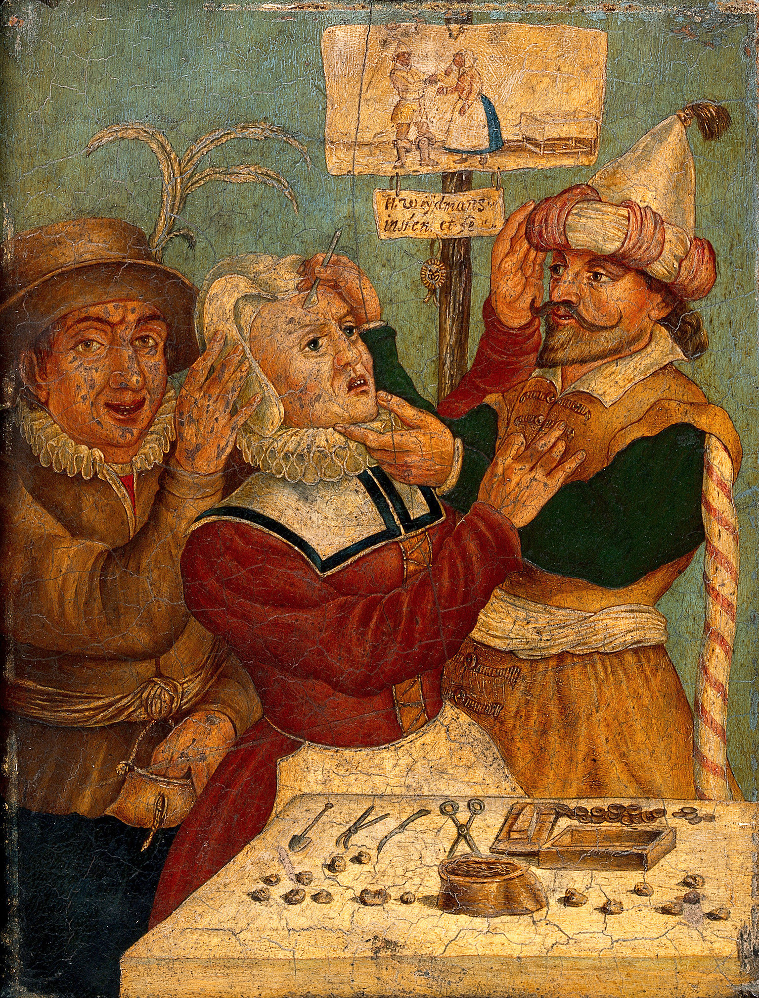 The stone operation